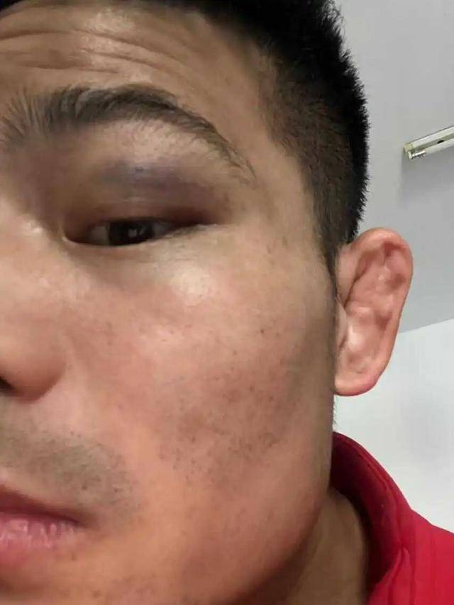 全国武术散打季军称遭多名运动员群殴霸凌，患上重度抑郁